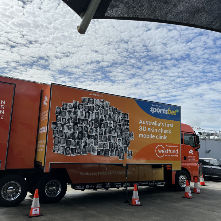 Hutchies hosts skin cancer checks